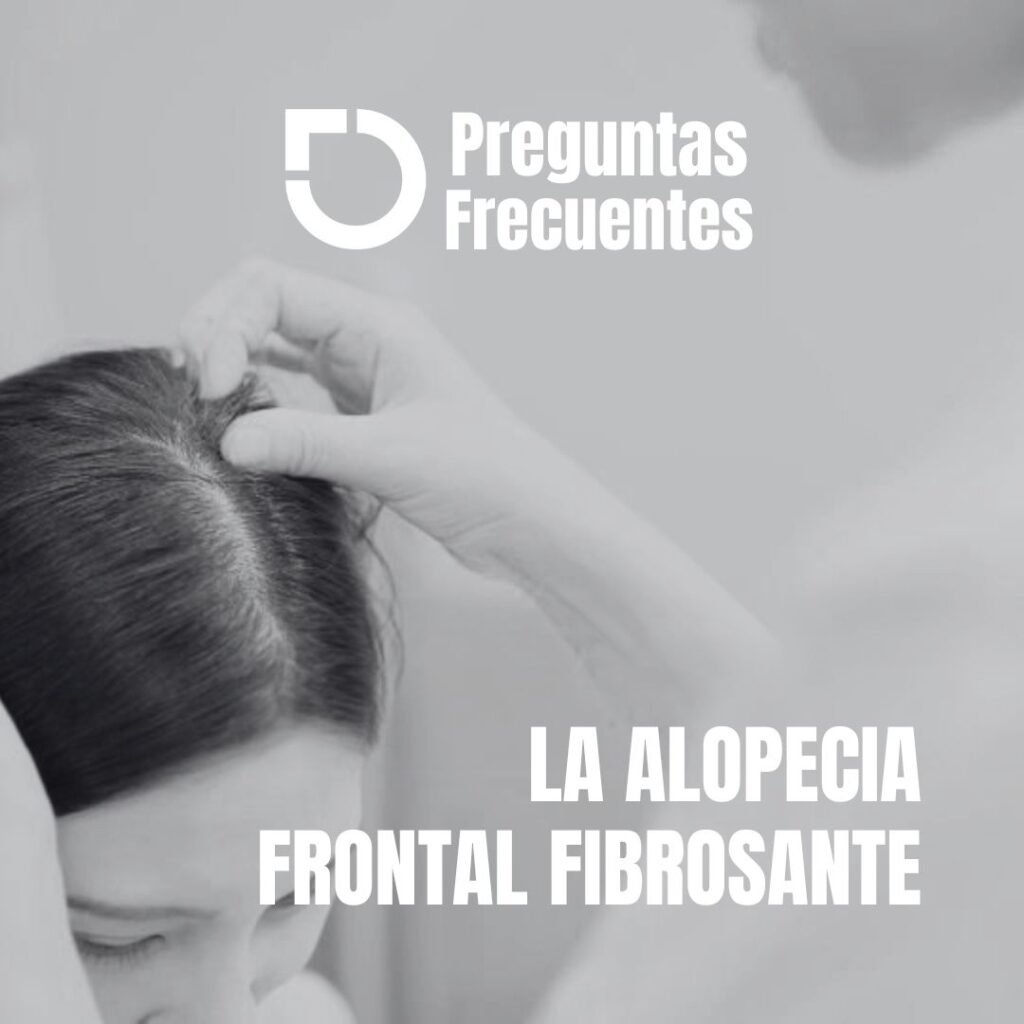 240529 pregfrecalopeciafrontal